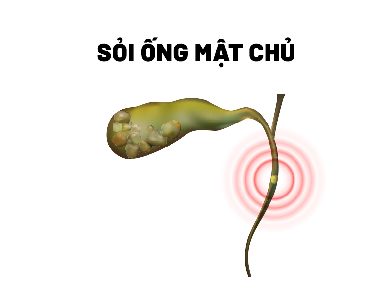 dau-quan-bung-phat-hien-soi-ong-mat-chu